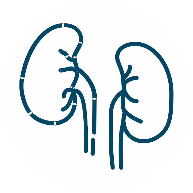 Kidney and bladder cancer