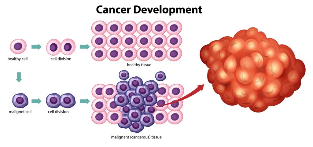 Cancer Development