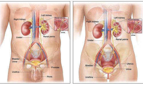 Kidney & Bladder Tumors: Symptoms, Risks & When to See a Doctor