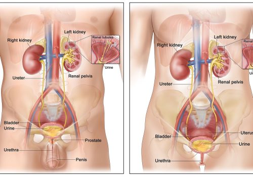 Kidney & Bladder Tumors: Symptoms, Risks & When to See a Doctor