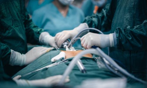 How Laparoscopic Surgery Makes Cancer Recovery Easier